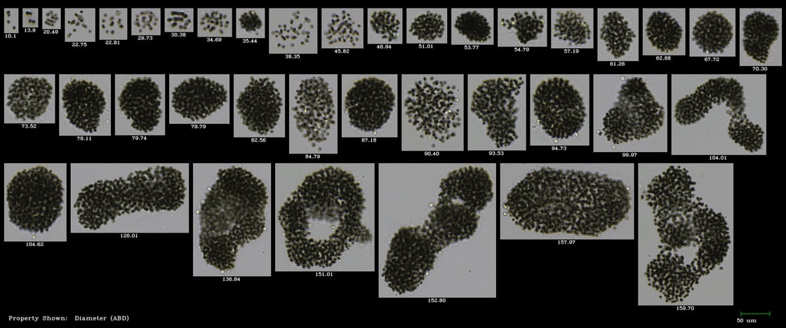 Microcystis FlowCam Cyano 10XLake Okeechobee Sept 2018