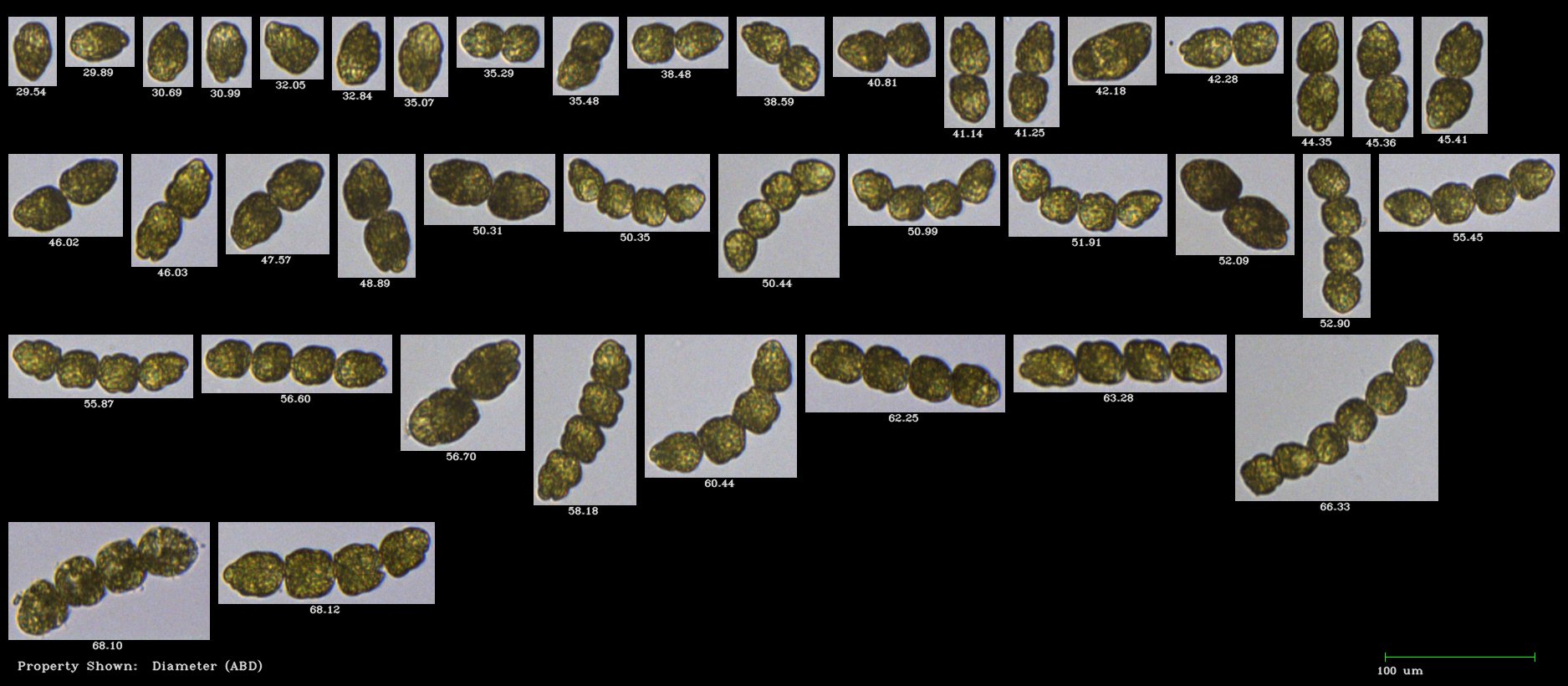 FlowCam collage of Margalefidinium harmful algae