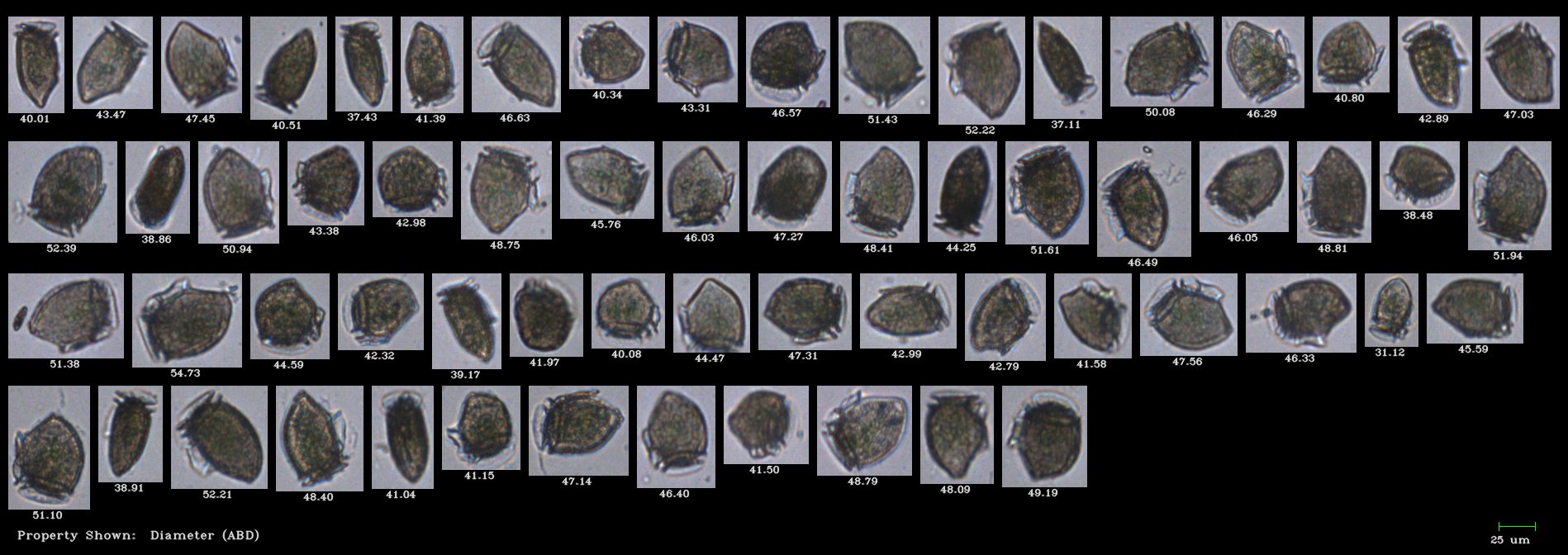 FlowCam collage of harmful algae Dinophysis norvegica