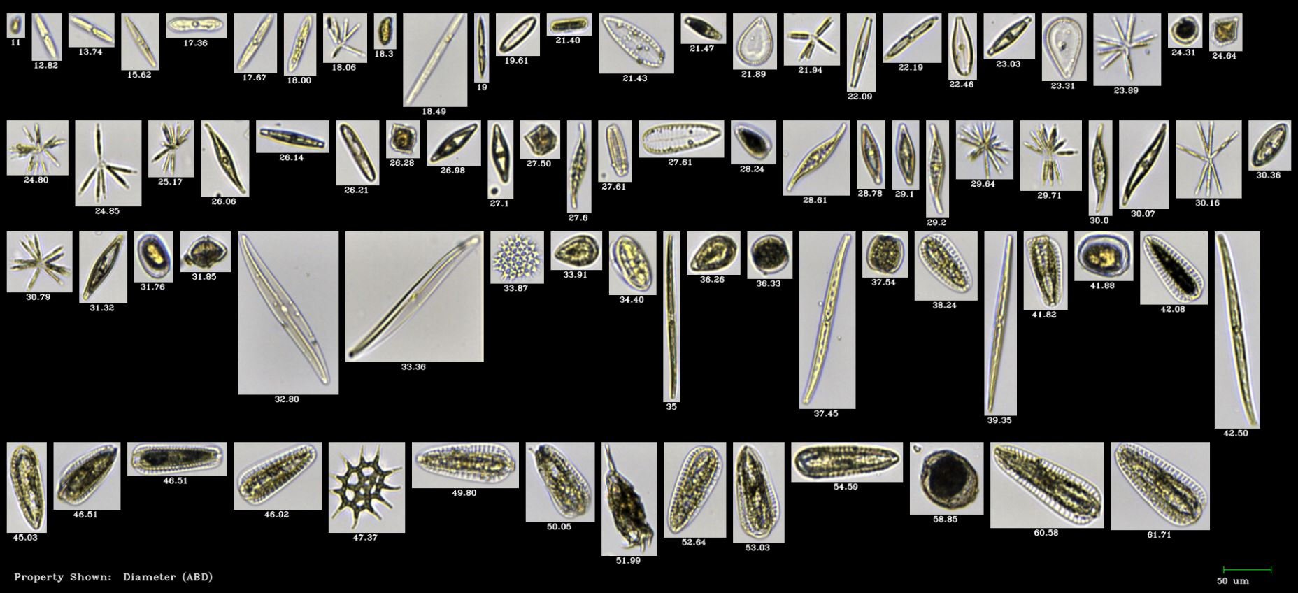 FlowCam Cyano collage of plankton from Anacosta River
