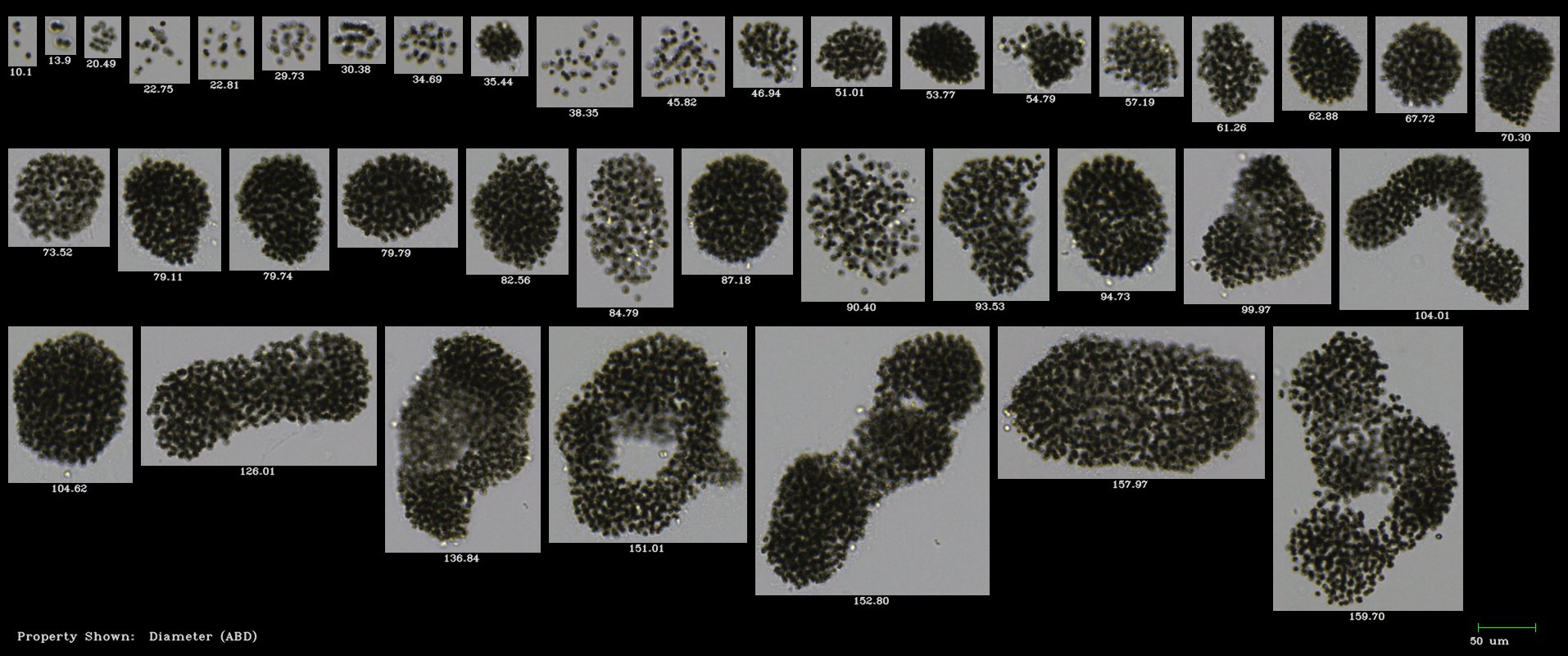 FlowCam Cyano collage of microcystis harmful algae colonies